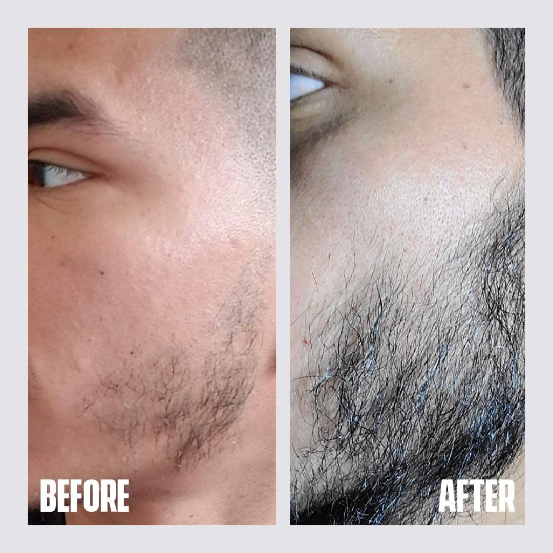 Dr. Alies Professional Beard Growth Oil | Natural Formula with Vitamin E, Almond Oil & Castor Oil