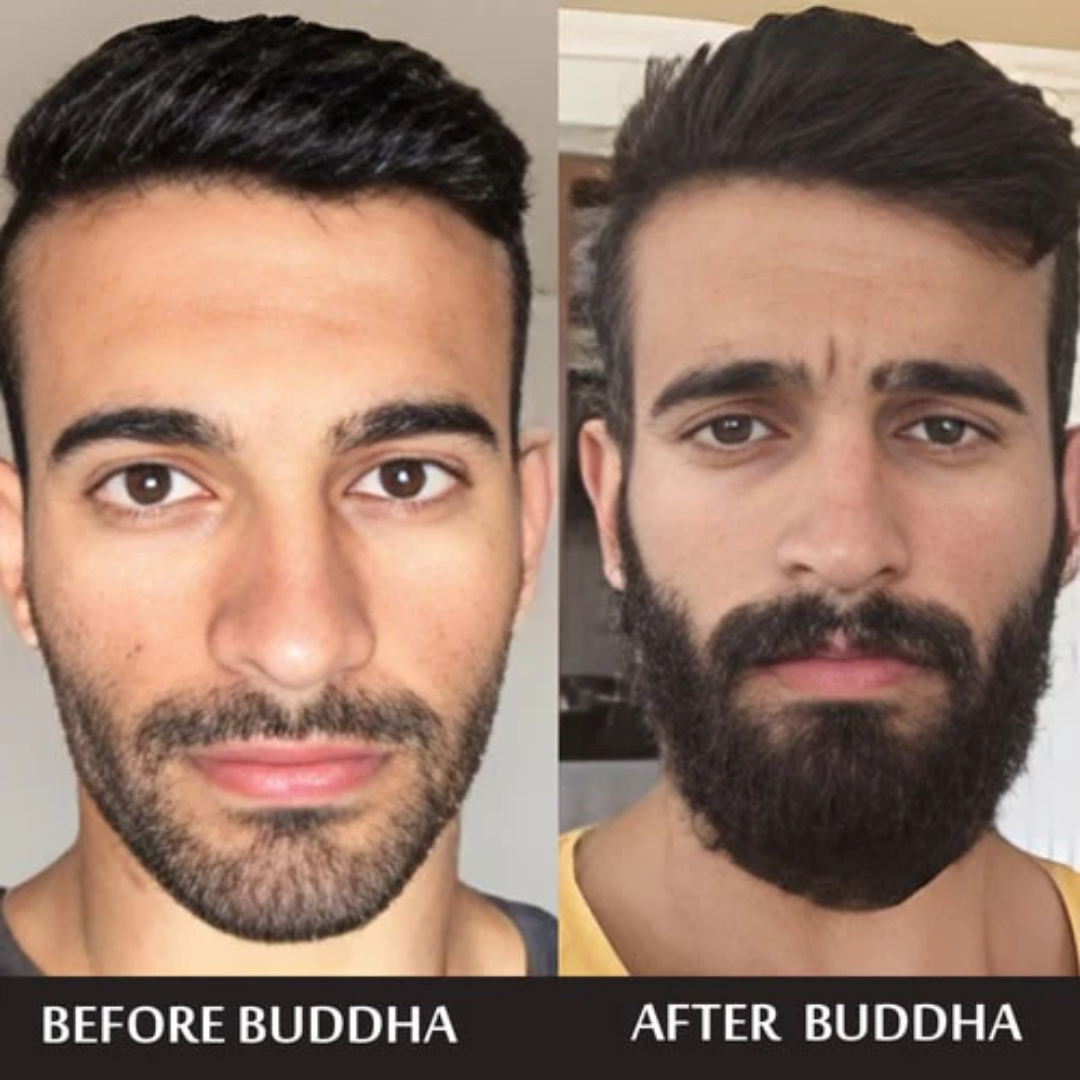 Dr. Alies Professional Beard Growth Oil | Natural Formula with Vitamin E, Almond Oil & Castor Oil